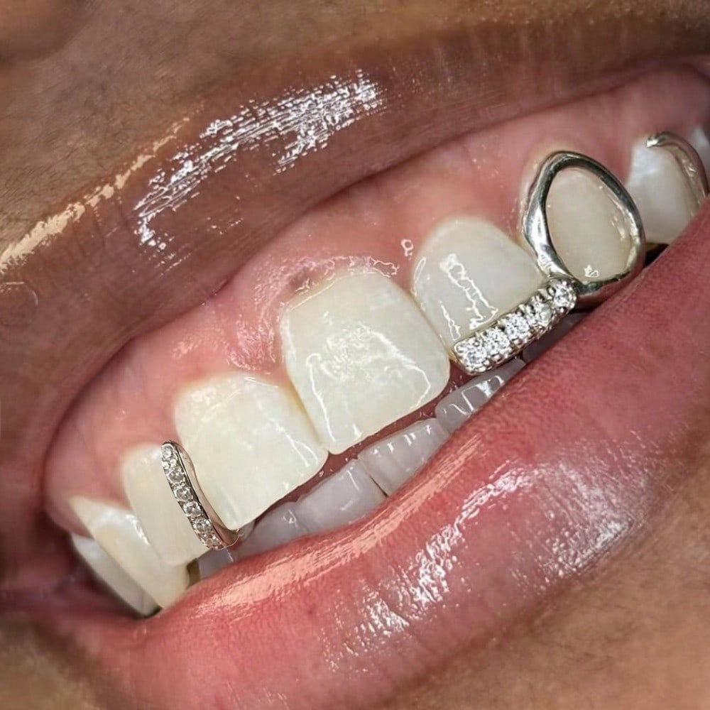 RAPIKING 2pcs Stylish Hip Hop Grillz - Punk Style, Cubic Zirconia Inlaid, Unisex Teeth Caps for Streetwear Fashion, Ideal Christmas & Carnival Gifts SS69