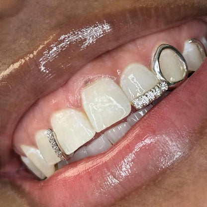 RAPIKING 2pcs Stylish Hip Hop Grillz - Punk Style, Cubic Zirconia Inlaid, Unisex Teeth Caps for Streetwear Fashion, Ideal Christmas & Carnival Gifts SS69