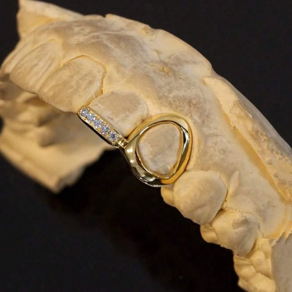 RAPIKING 2pcs Stylish Hip Hop Grillz - Punk Style, Cubic Zirconia Inlaid, Unisex Teeth Caps for Streetwear Fashion, Ideal Christmas & Carnival Gifts SS69